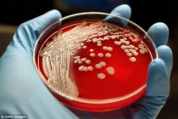 antibiotic 4