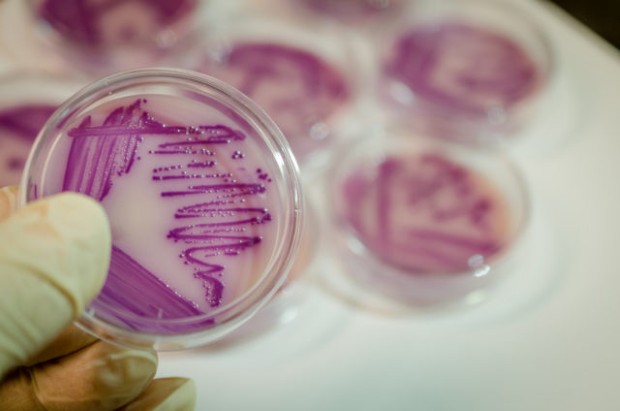 Bacterial culture plate with E. coli colony