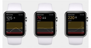 Apple Watch би можел да го мониторира шеќерот во крвта благодарение на една британска IT компанија