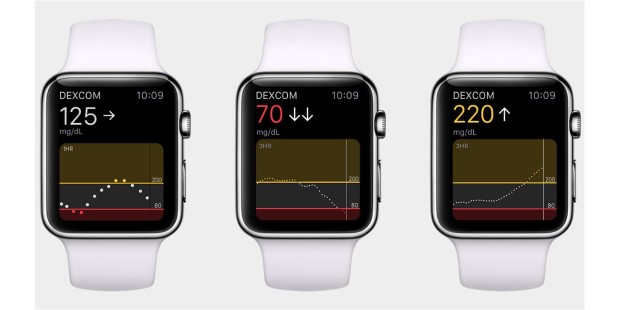 applewatch2
